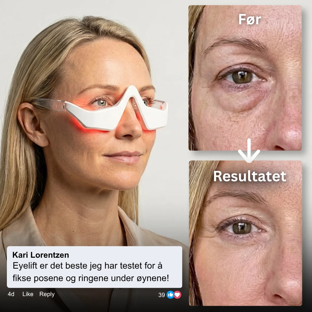 EyeLift® - Fjerner poser og ringer under øynene