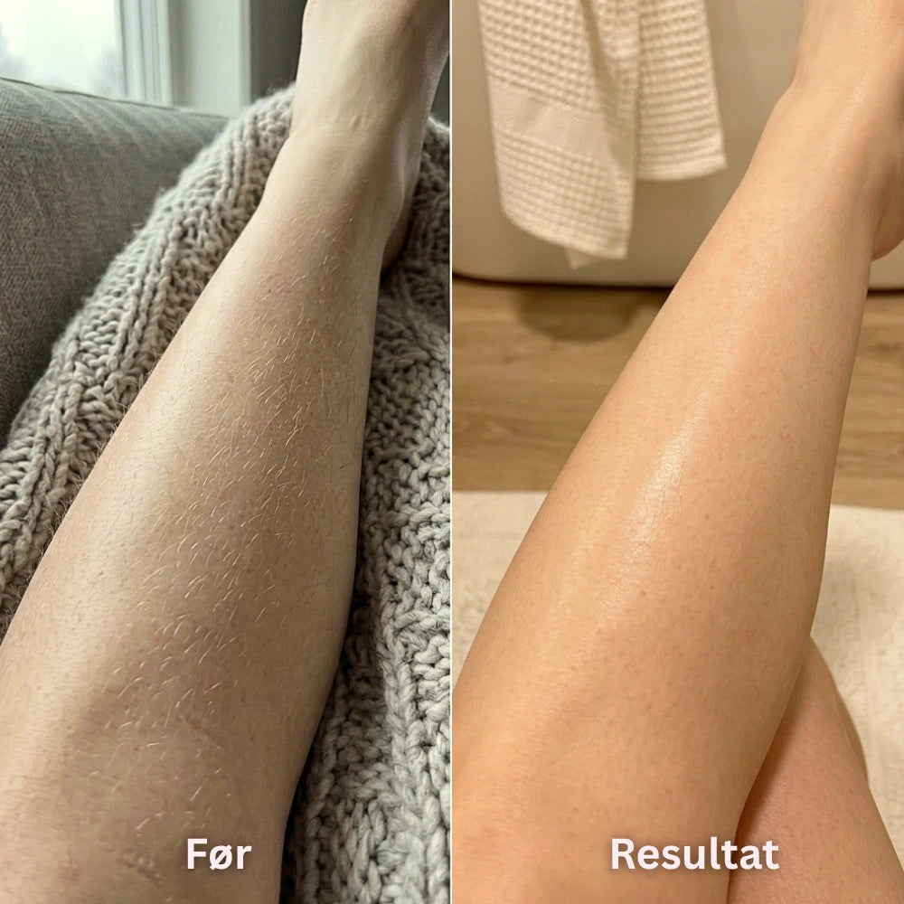 Silky® IPL-Laser - Permanent fjerning av kroppshår