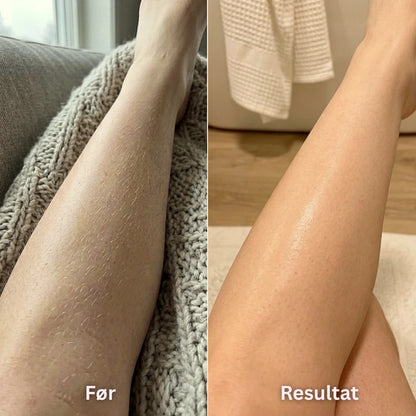 Silky® IPL-Laser - Permanent fjerning av kroppshår