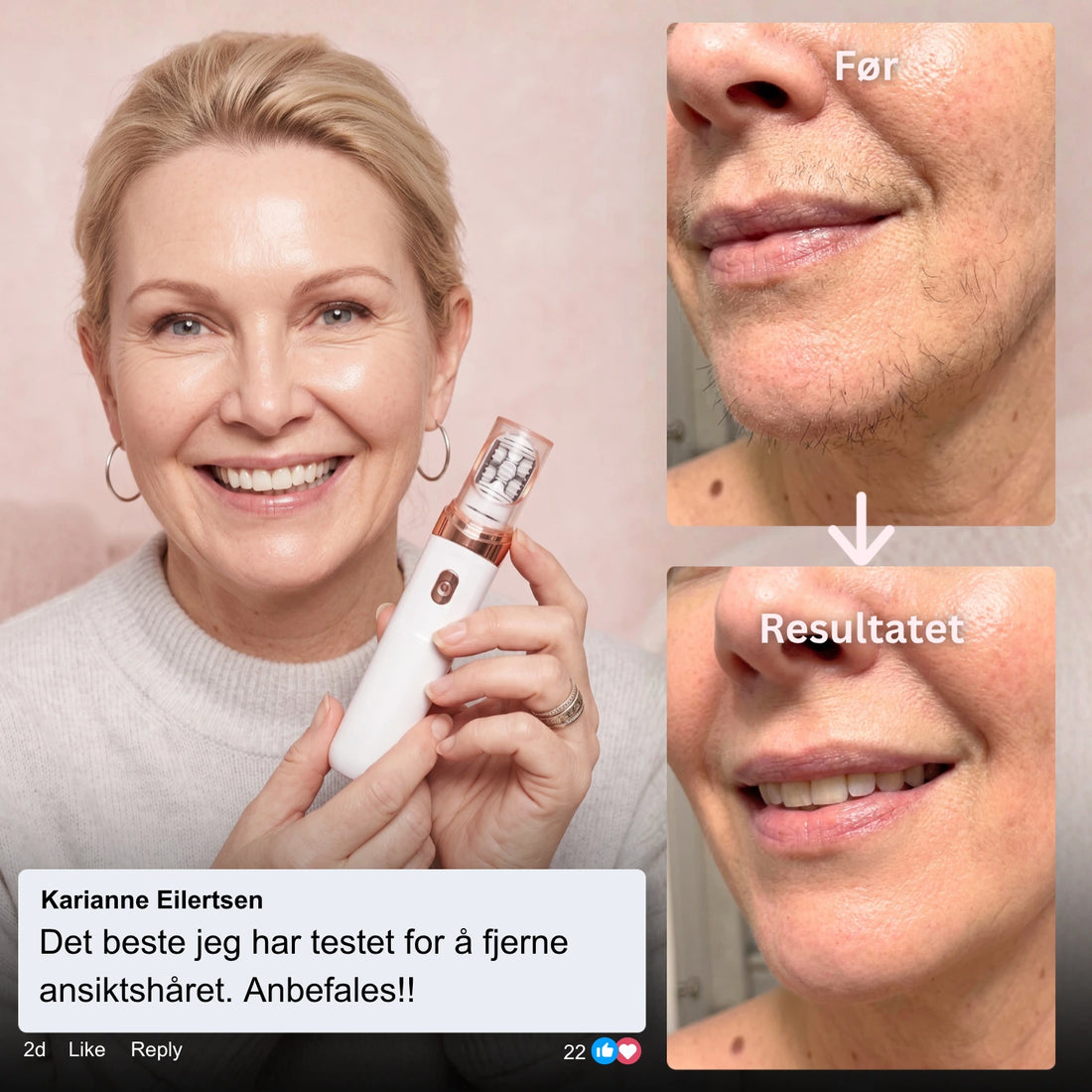 Epimax® - Fjerner alle typer ansiktshår på sekunder